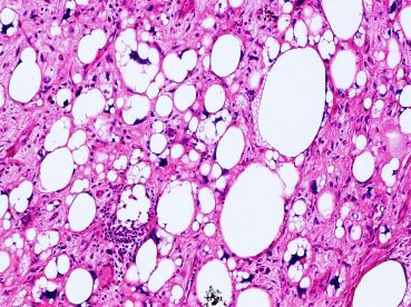 Pathology books